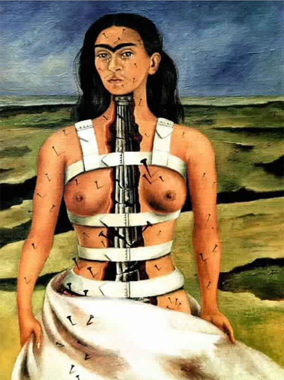 Frida Khalo - Souffrance